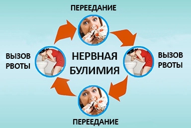 Лечение булимии в Вилюйске